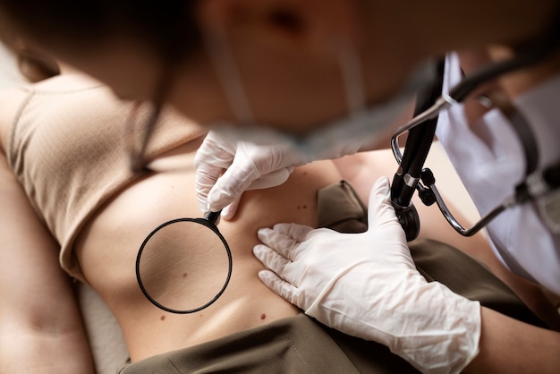 Female doctor diagnosing a melanoma on the body of a female patient