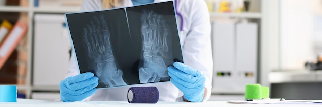 Female doctor examines an xray of patient leg symptoms and diagnosis of osteoporosis