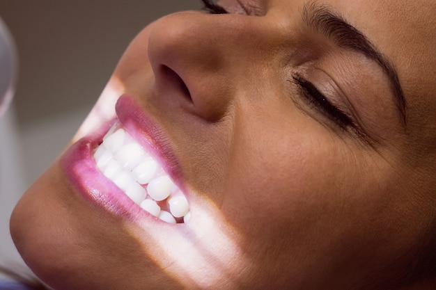 Female patient receiving a dental treatment