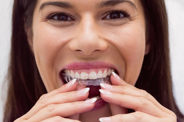 female patient wearing braces