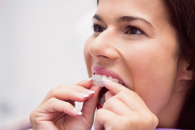 Female patient wearing braces