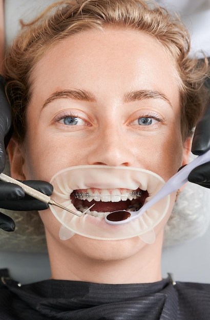 Free photo female patient with braces on teeth receiving orthodontic treatment