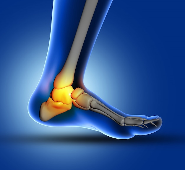 Foot joint pain