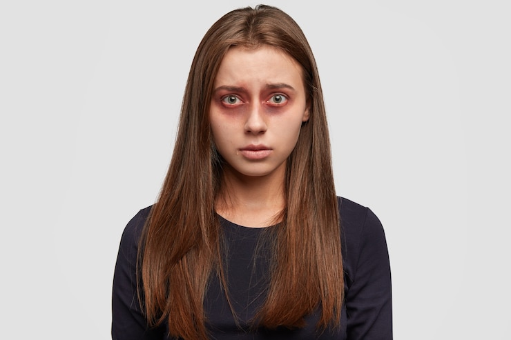 無料Photo 白い壁にポーズをとってあざを持つおびえた若い女性
