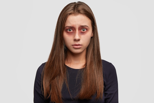 Frightened young woman with bruises posing against the white wall