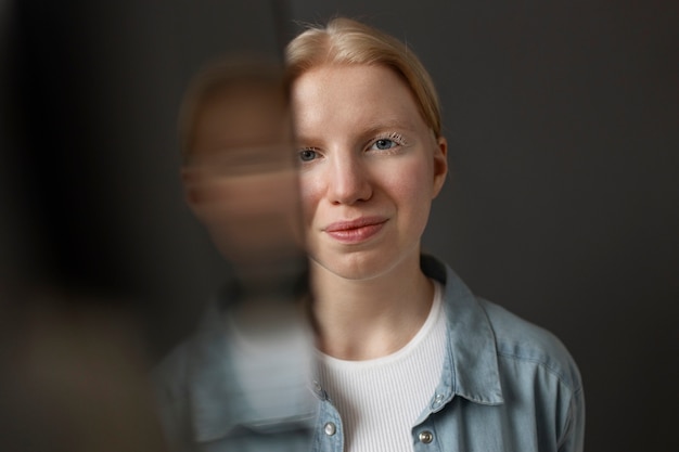 Free photo front view albino woman posing