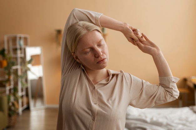 Free photo front view albino woman stretching