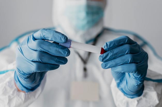 Free photo front view doctor holding a blood sample