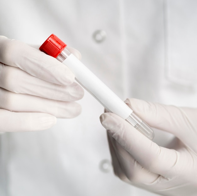 Free Photo front view of doctor with surgical gloves holding tube