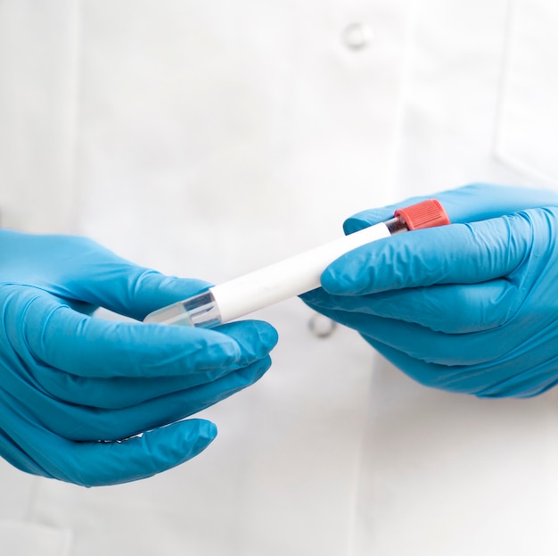 Free Photo front view of doctor with surgical gloves holding tube