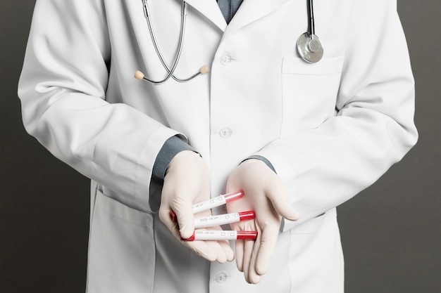 Front view of doctor with surgical gloves holding vacutainers