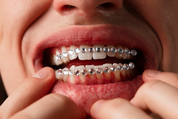 Front view man posing with dental gems