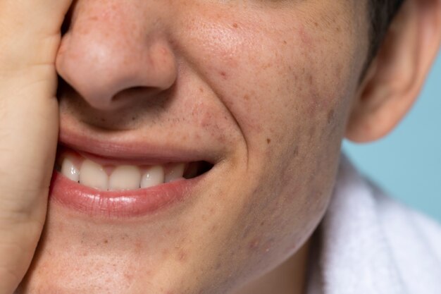 Front view smiley young man skin texture