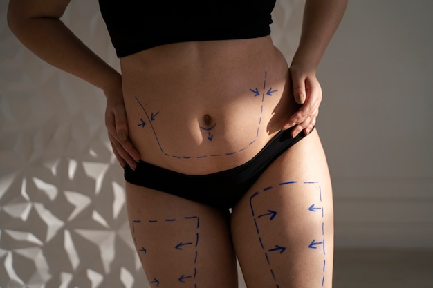 Free photo front view woman's body with marker traces