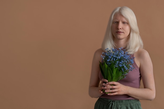 Front view woman with albinism posing in studio