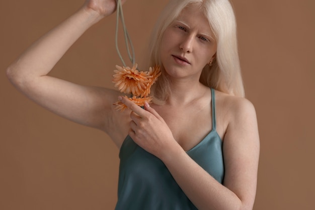 Free photo front view woman with albinism posing in studio