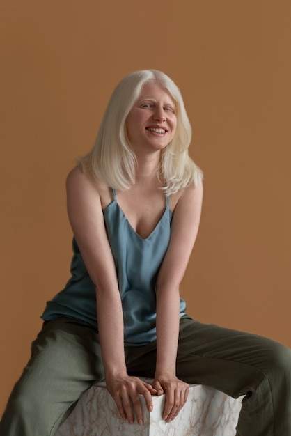 Free photo front view woman with albinism posing in studio