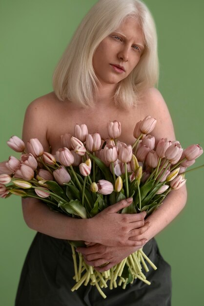 Front view woman with albinism posing in studio