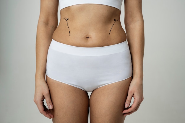 Front view woman with marker traces on abdomen