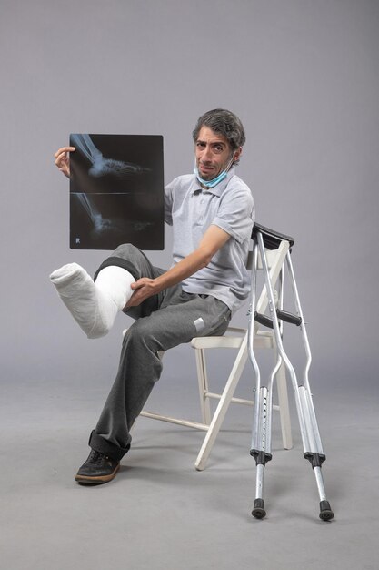 Вид спереди молодого мужчины, сидящего со сломанной ногой и держащего рентгеновский снимок на сером полу, боль в ноге, авария, скручивание стопы, мужчина