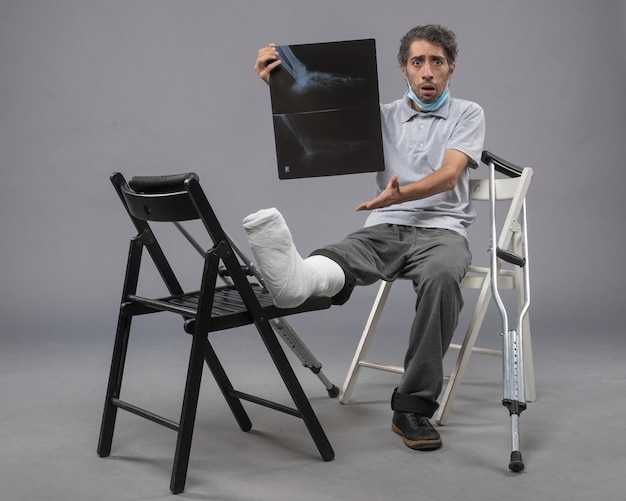부러진 발로 앉아 회색 벽에 엑스레이를 들고 있는 앞모습 젊은 남성은 통증 발 다리 부러진 남성 사고