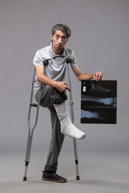 Front view young male with broken foot using crutches and holding his x-ray on grey desk pain disable leg broken accident foot