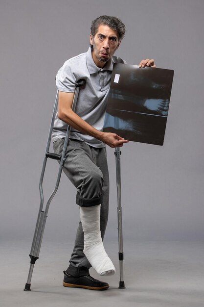 Front view young male with broken foot using crutches and holding his x-ray on grey desk pain disable twist broken accident foot