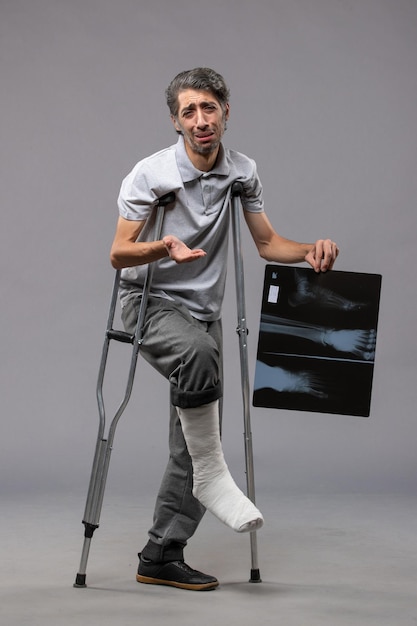 목발을 사용하여 발이 부러지고 회색 바닥 통증에 엑스레이를 들고 있는 전면 보기 젊은 남성은 부러진 사고 발을 비활성화합니다