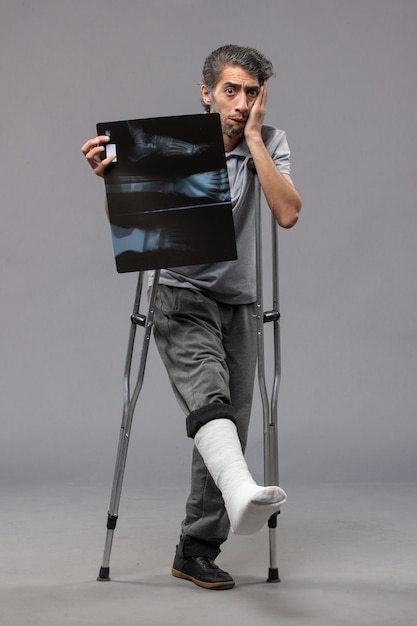 목발을 사용하여 발이 부러지고 회색 벽에 엑스레이를 들고 있는 전면 보기 젊은 남성은 사고 발 비틀림 부러진 통증을 비활성화합니다