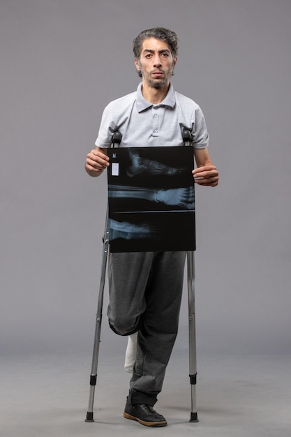 Вид спереди молодого мужчины со сломанной ногой, использующего костыли и держащего рентгеновский снимок на серой стене, скручивание стопы, сломанная боль, авария
