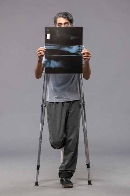 Foto gratuita vista frontale giovane maschio con piede rotto usando le stampelle e tenendo la sua radiografia sul muro grigio dolore disabilita la gamba rotta incidente piede