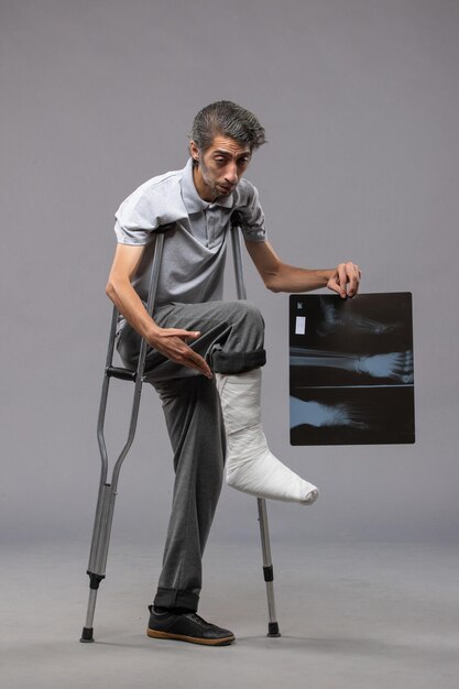 Вид спереди молодого мужчины со сломанной ногой, использующего костыли и держащего рентгеновский снимок на серой стене.
