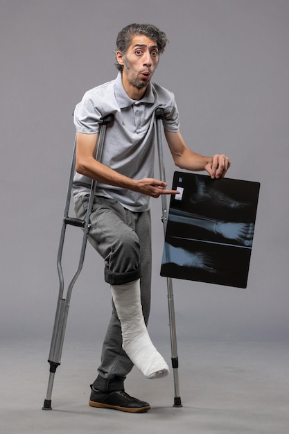 松葉杖を使用し、灰色の壁の痛みに彼のX線を保持している骨折した足の正面図若い男性はねじれ壊れた事故の足を無効にします