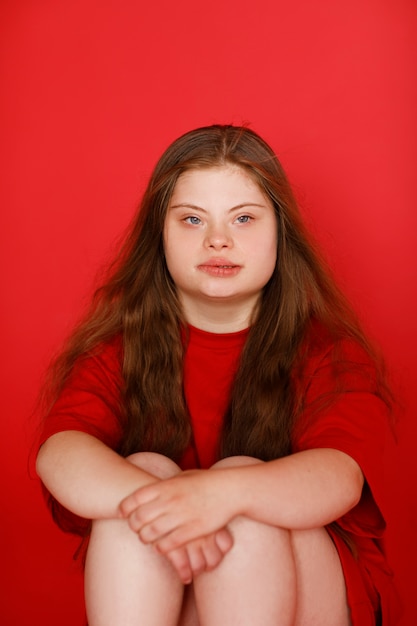 Free photo front view young woman with down syndrome