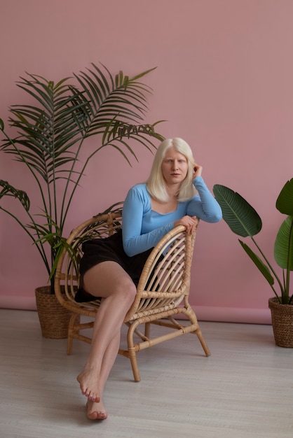 Full shot woman with albinism posing in studio