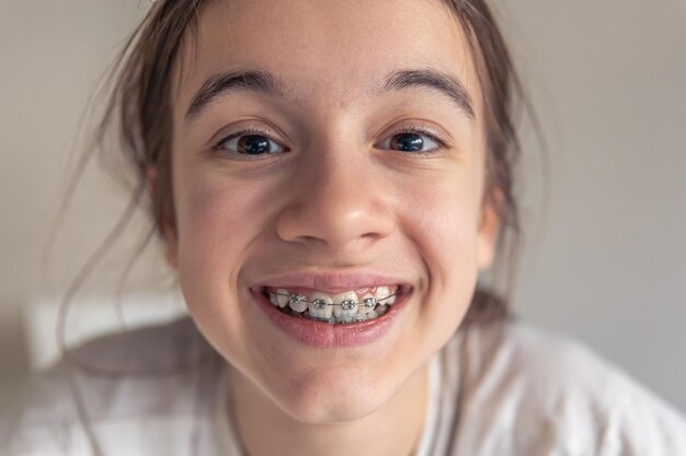 A funny teenage girl looks at the camera and demonstrates braces on her teeth