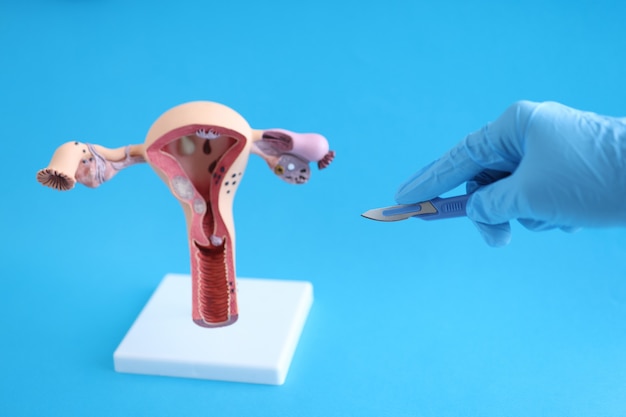 Gloved hand of doctor stretches scalpel to female reproductive system surgery to remove the