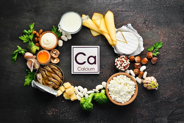 カルシウム​が​豊富な​製品​の​グループ​。​健康的​な​食事​：​チーズ​、​ミルク​、​パルメザンチーズ​、​サワークリーム​、​魚​、​アーモンド​、​パセリ​、​ニンニク​、​ブロッコリー​。​古い​背景​に​。​上面図​。​空き​コピー​スペース​。