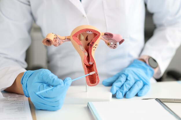 Gynecologist holds urogenital cytobrushes and model of female reproductive system female