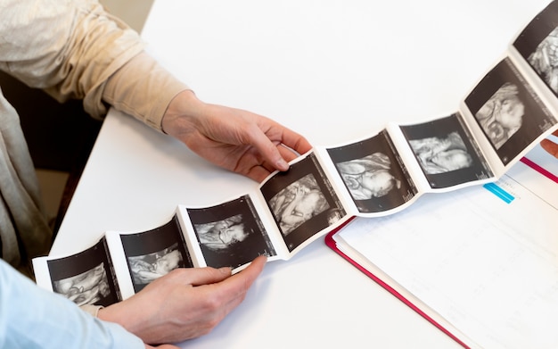 gynecologist offering couple ultrasound pictures