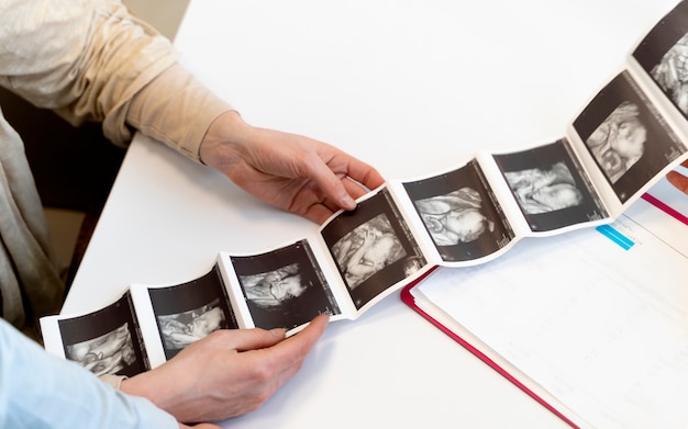 Gynecologist offering couple ultrasound pictures