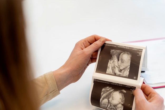 カップルの超音波写真を提供する産婦人科医