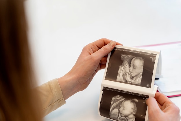 Gynecologist offering couple ultrasound pictures