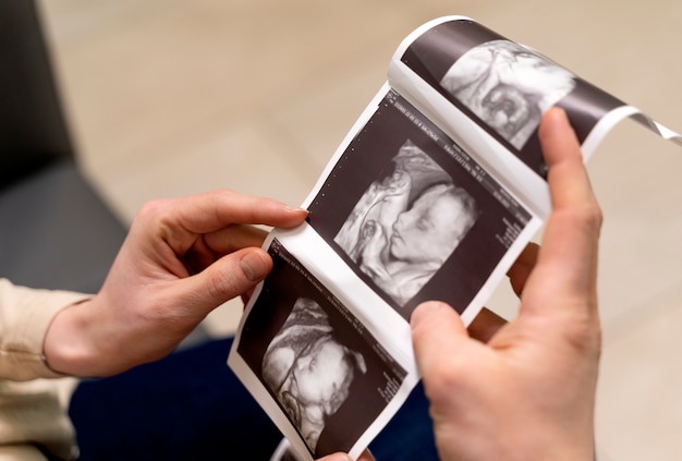 Gynecologist offering couple ultrasound pictures