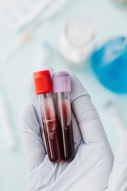Free Photo hand of doctor holding blood test tubes during covid-19 outbreak