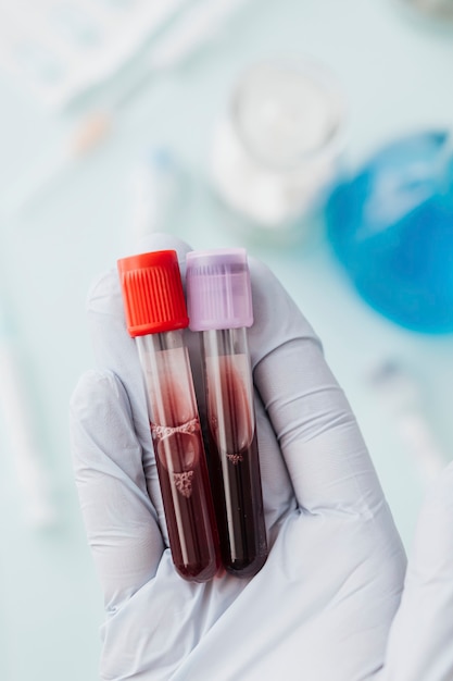 Hand of doctor holding blood test tubes during covid-19 outbreak