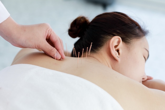 Hand of doctor performing acupuncture therapy . asian female undergoing acupuncture treatment with a line of fine needles inserted into the her body skin in clinic hospital Premium Photo