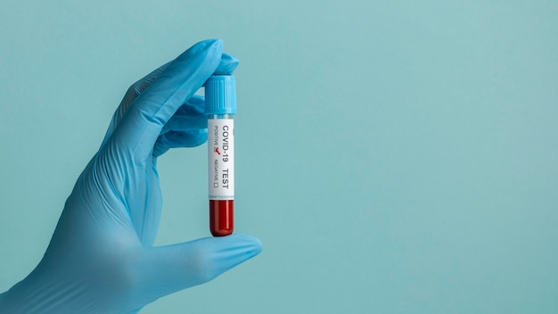 Hand with protective gloves holding a blood sample for covid test