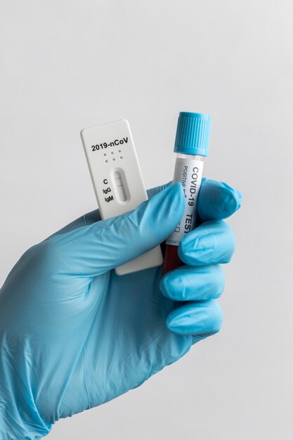 Hand with protective gloves holding a blood sample for covid test