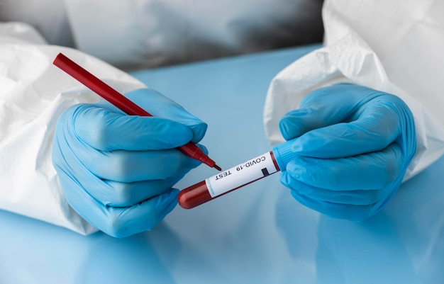 Hand with protective gloves holding a blood sample for covid test